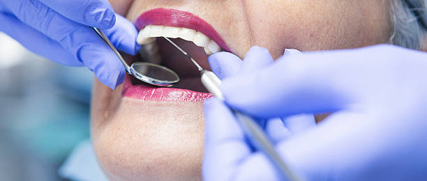 Best Emergency Care for Gum Disease in Shreveport, LA